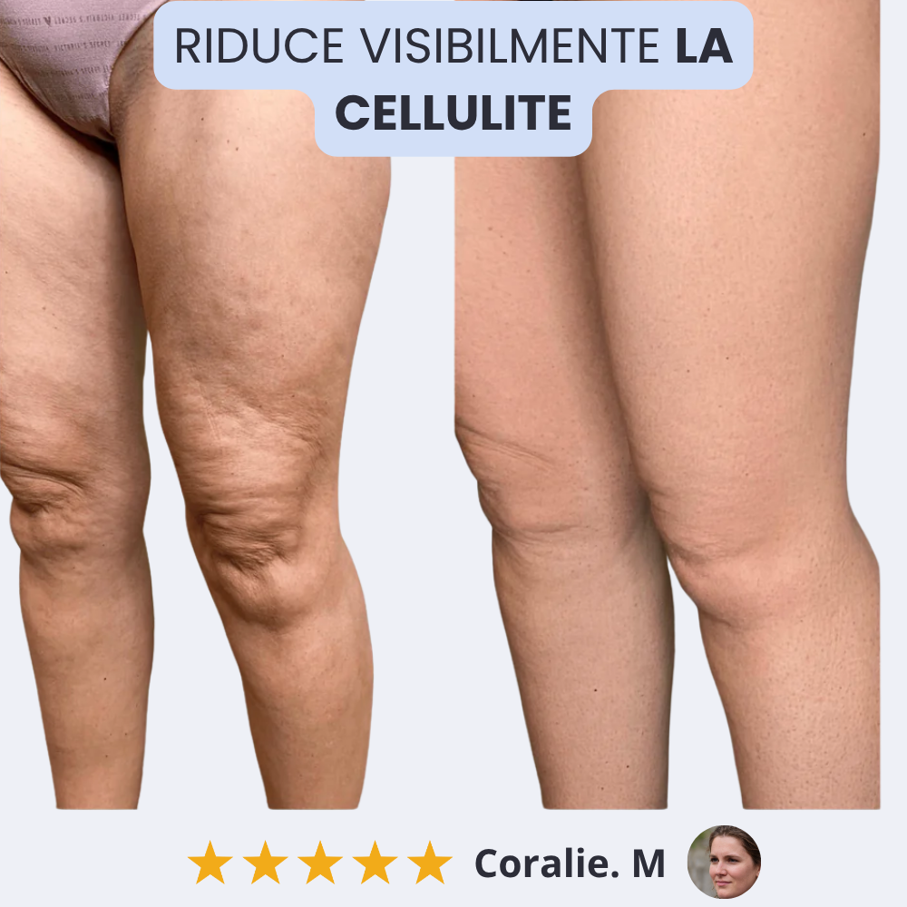 Vibra Shape Pro®